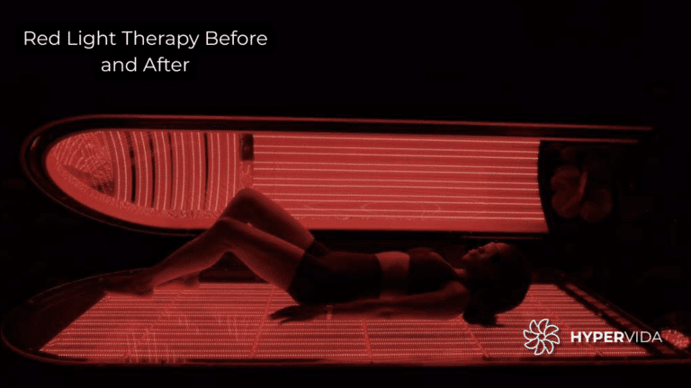 red light therapy before and after