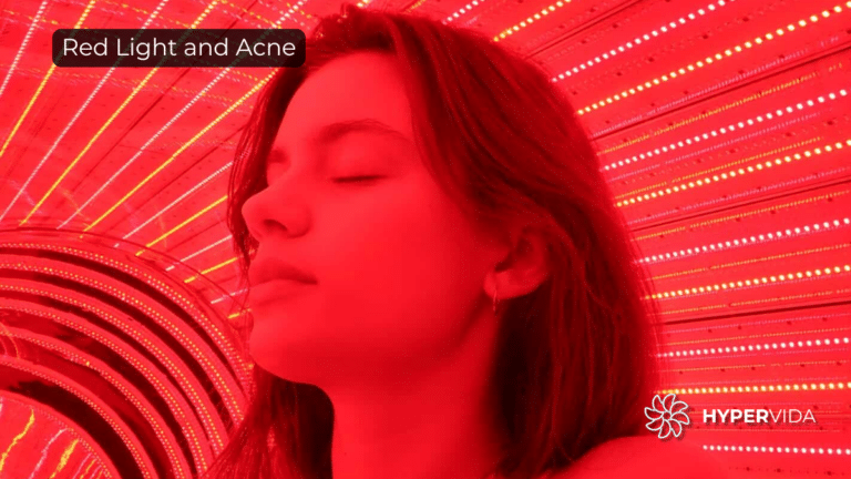 red light for acne